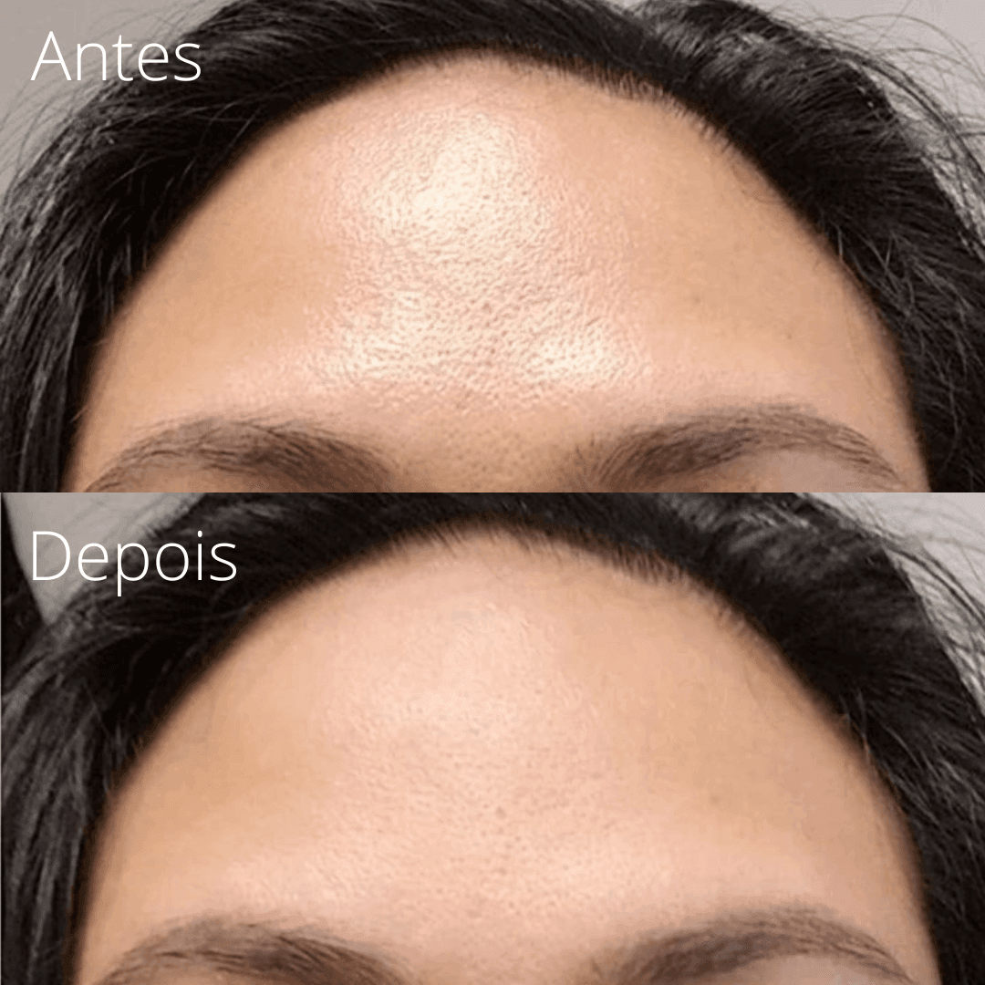 Vulcânica - Removedor de Oleosidade