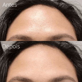 Vulcânica - Removedor de Oleosidade